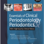 Essentials of Clinical Periodontology and Periodontics